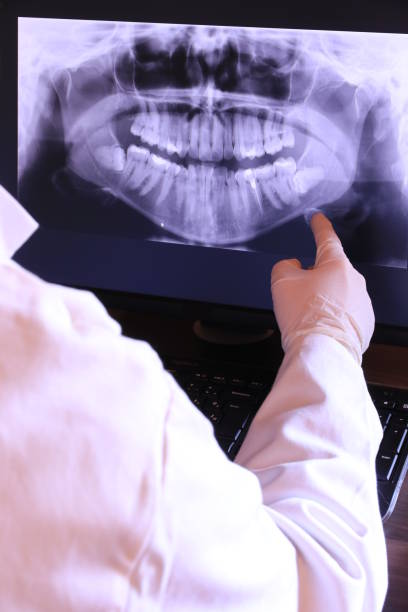 Best Emergency Treatment for Dental Infections or Abscesses in Northglenn, CO